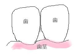 f:id:i-shizukichi:20190801193127j:plain