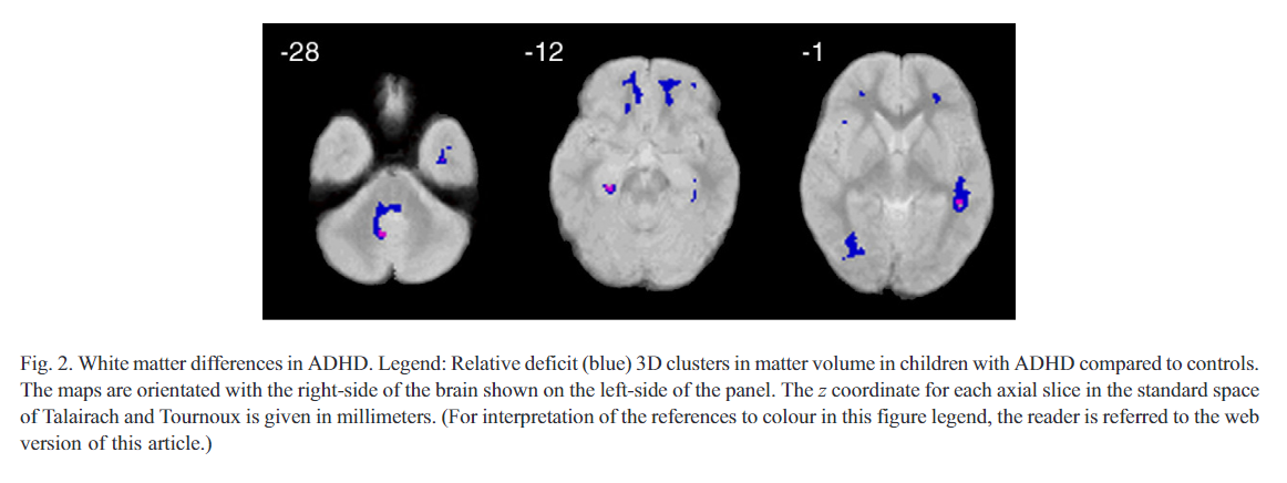 f:id:iDES:20200818052902p:plain