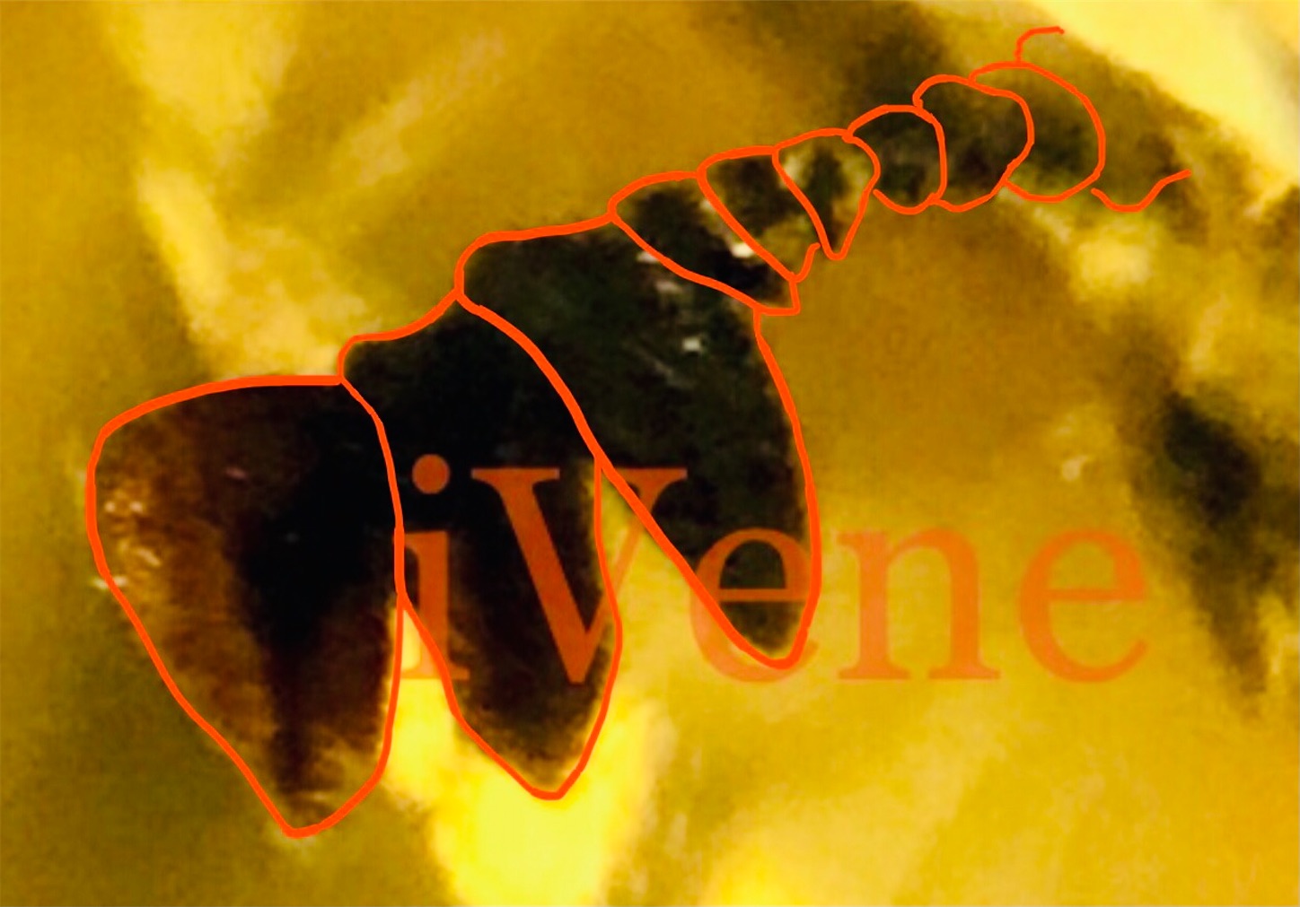 f:id:iVene:20220125221058j:image f:id:iVene:20220125221058j:image