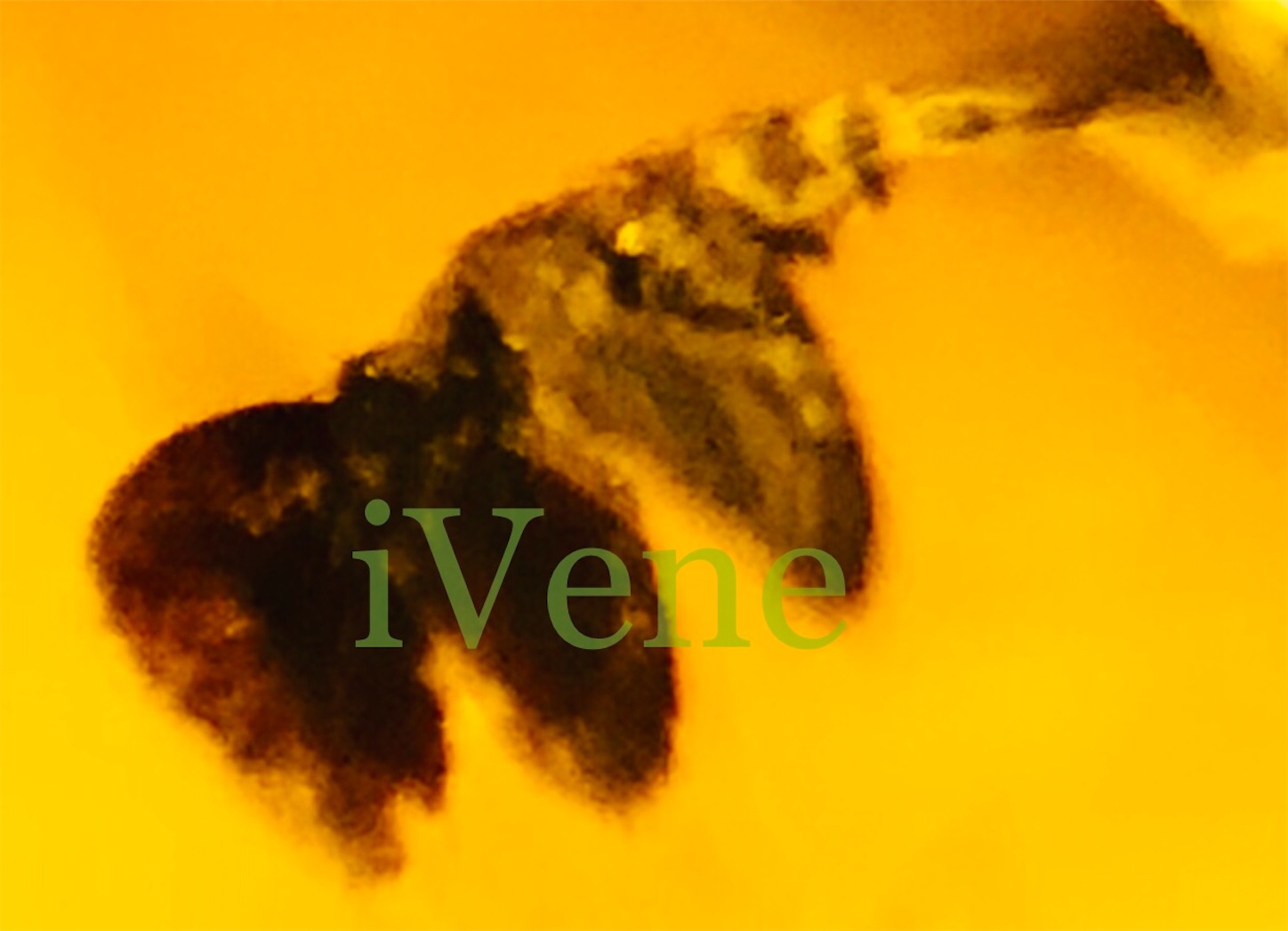 f:id:iVene:20220125221107j:image f:id:iVene:20220125221107j:image