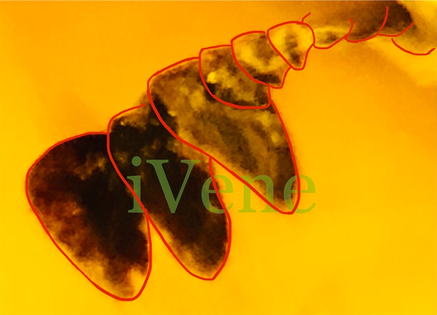 f:id:iVene:20220125221111j:image f:id:iVene:20220125221111j:image