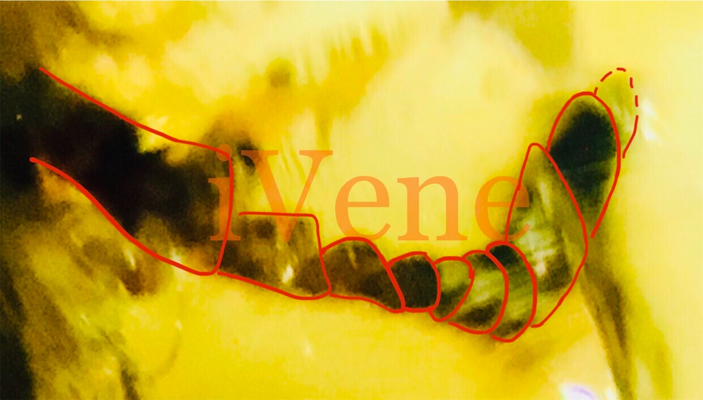 f:id:iVene:20220126005119j:image f:id:iVene:20220126005119j:image