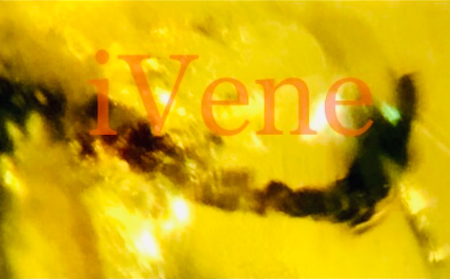 f:id:iVene:20220126203625j:image f:id:iVene:20220126203625j:image