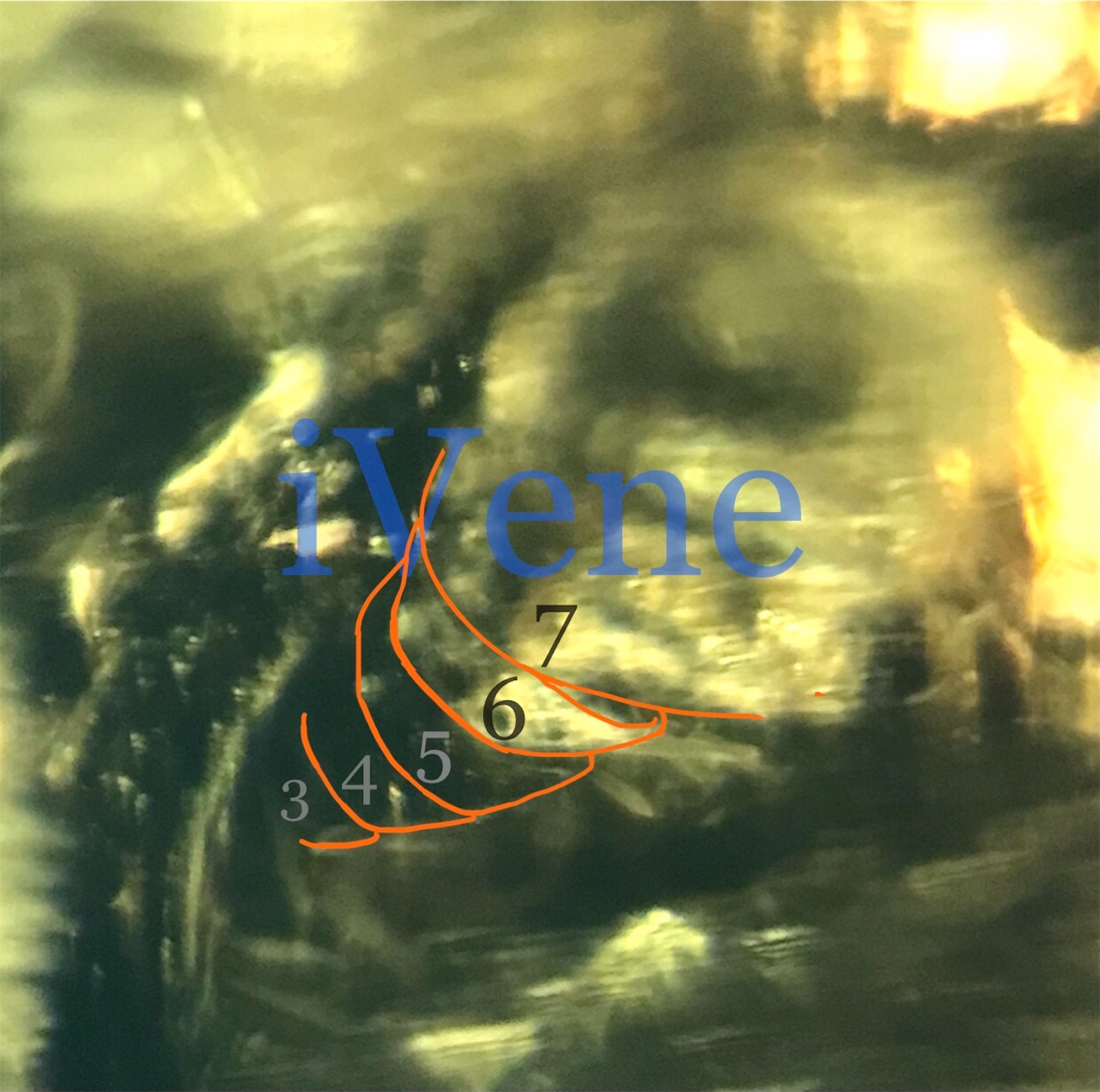 f:id:iVene:20220218231839j:image f:id:iVene:20220218231839j:image