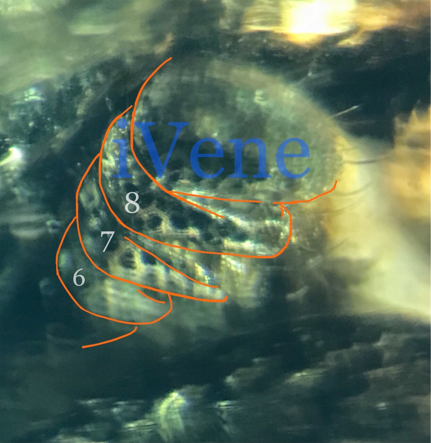 f:id:iVene:20220218232551j:image f:id:iVene:20220218232551j:image