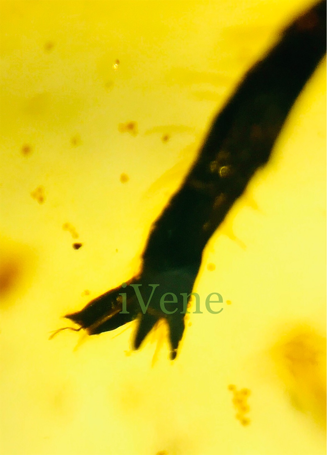 f:id:iVene:20220316094609j:image f:id:iVene:20220316094609j:image