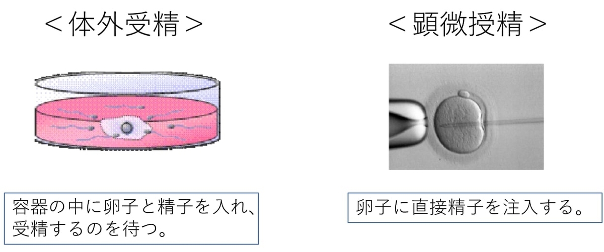 f:id:iamharukosan:20210427175255j:plain