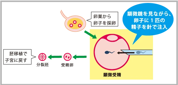 f:id:iamharukosan:20210427175302j:plain