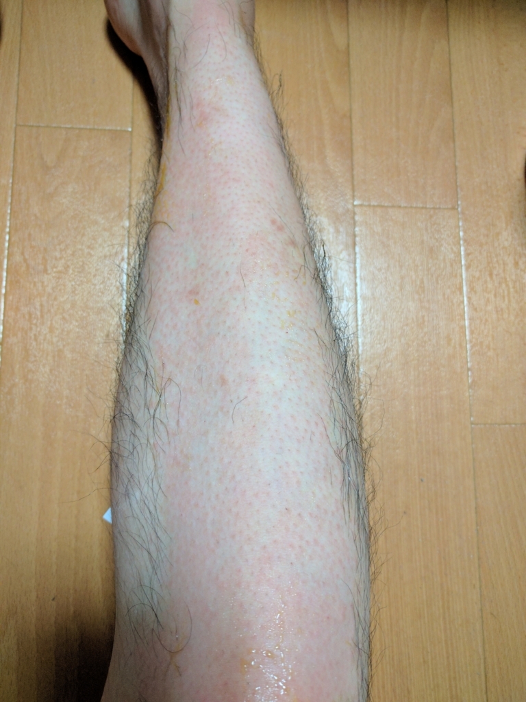 f:id:icezenzai:20170618201026j:plain