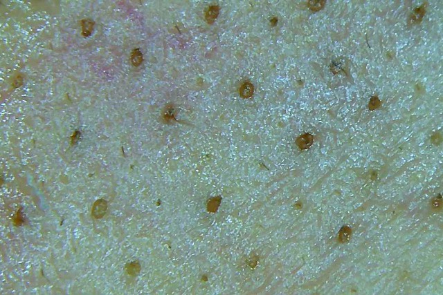 鼻だけ いちご鼻の原因は過剰な皮脂分泌 オイルフリー 目指せ毛穴レス いちご鼻と戦うちゃんの奮闘ブログ