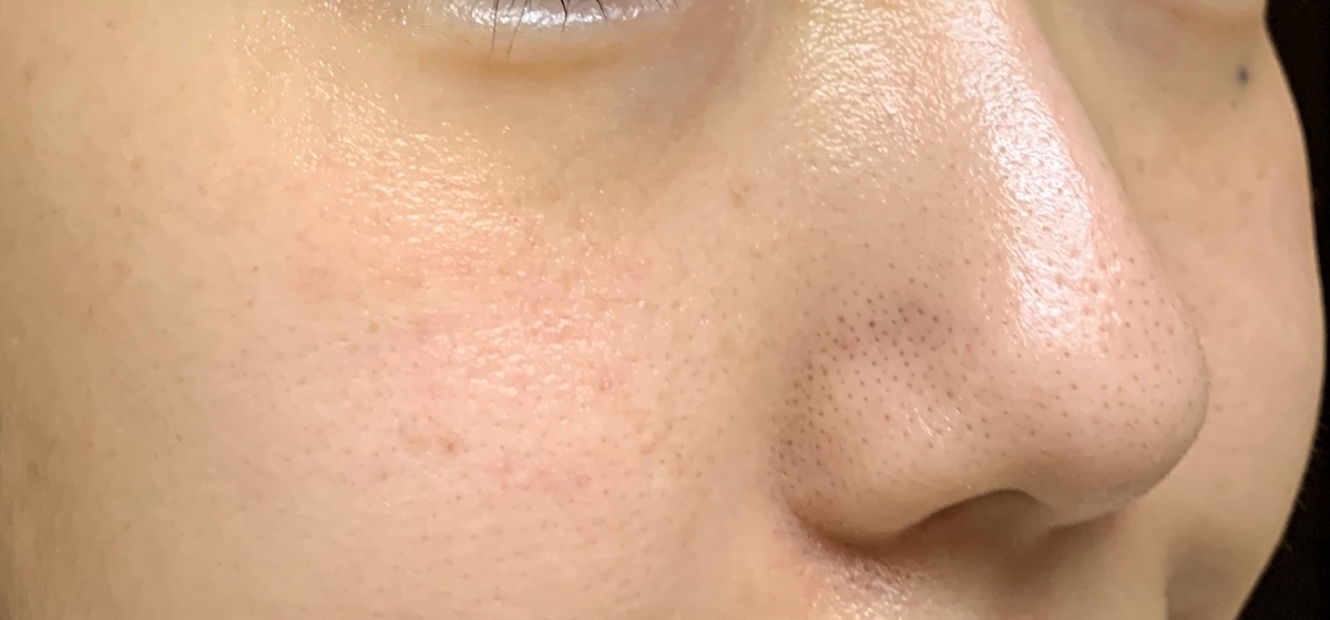 f:id:ichigobanachan:20200322144037j:plain f:id:ichigobanachan:20200322144037j:plain