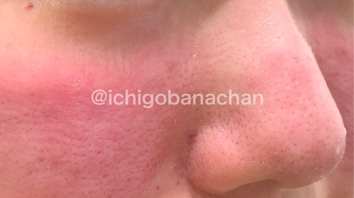 f:id:ichigobanachan:20210316152059j:plain