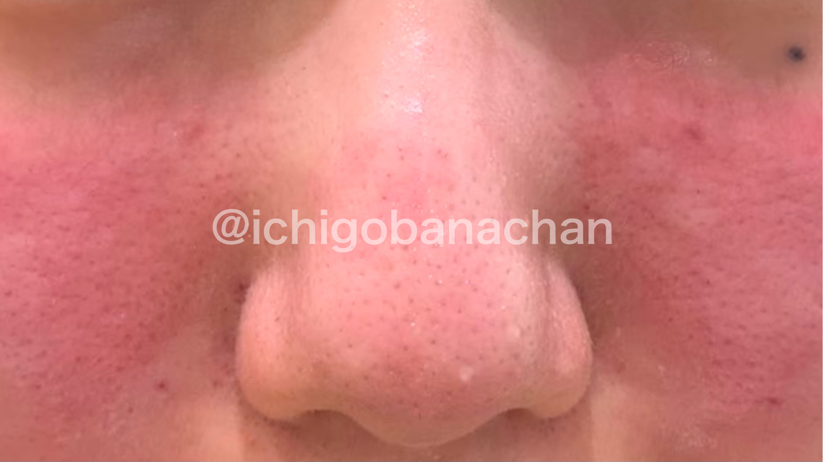 f:id:ichigobanachan:20210316152114j:plain