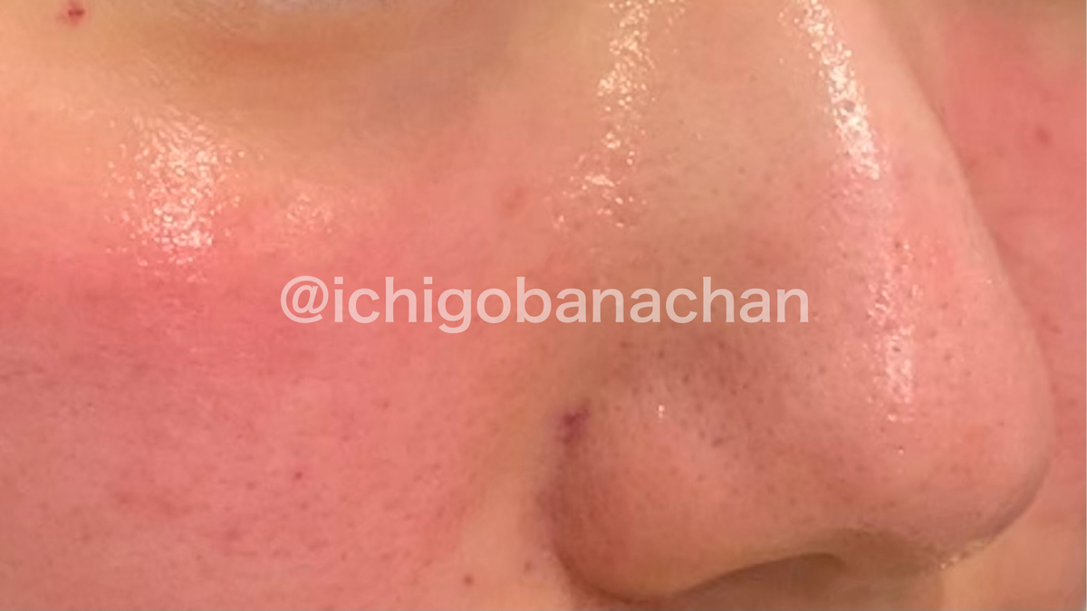 f:id:ichigobanachan:20210316152411j:plain
