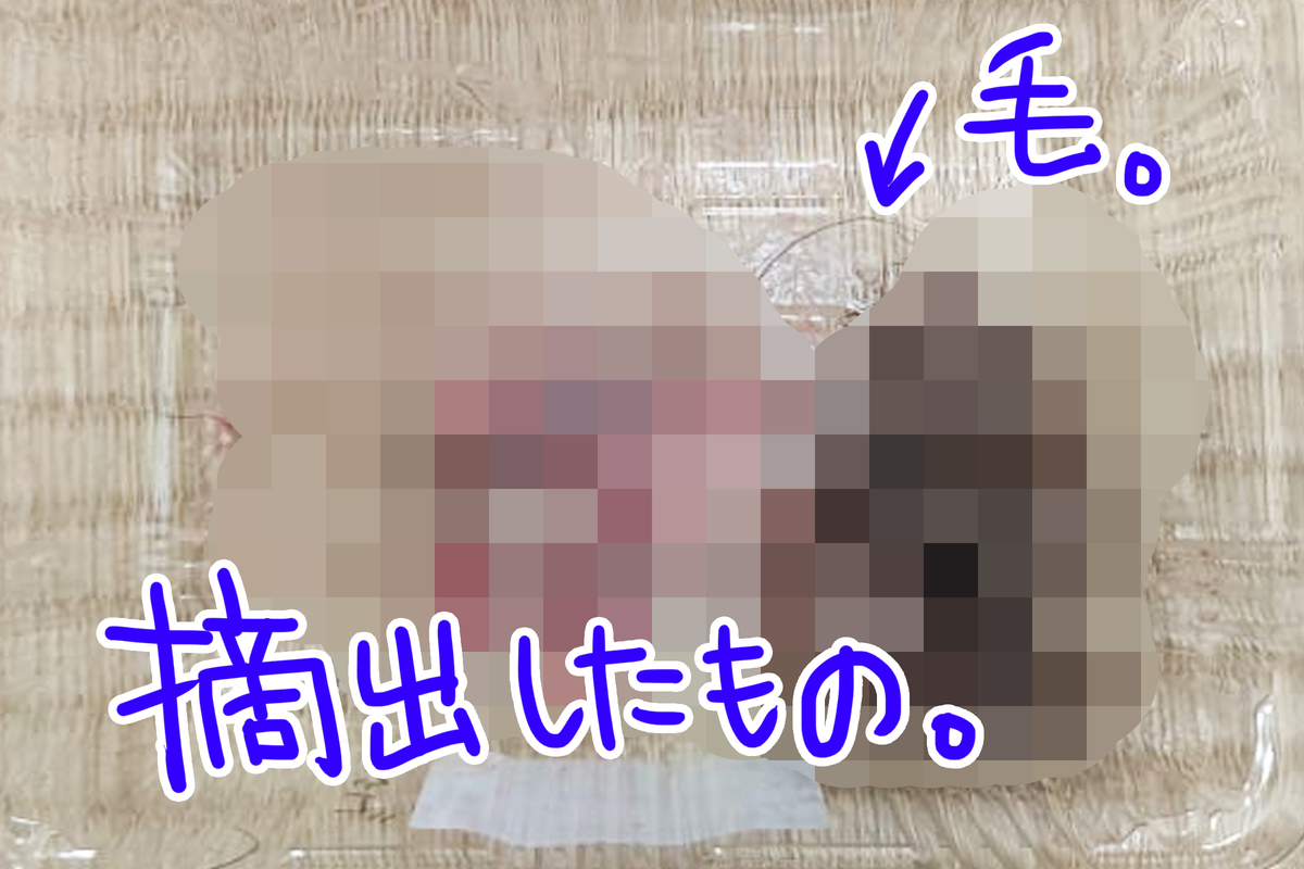 入院