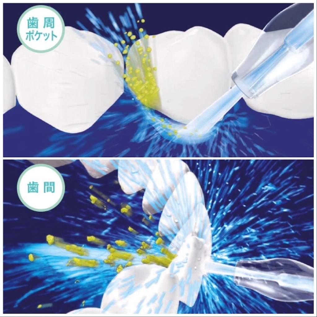 f:id:ikelog:20210228140321j:image f:id:ikelog:20210228140321j:image