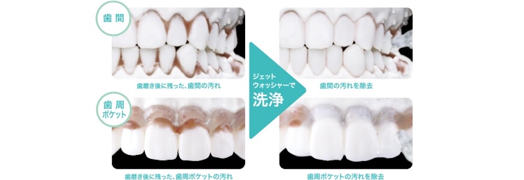 f:id:ikelog:20210228141028j:image f:id:ikelog:20210228141028j:image