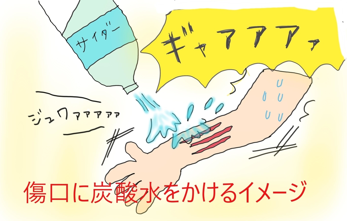 f:id:iku193193:20190909113511j:plain