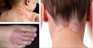 f:id:imammufroil:20160512121326j:plain