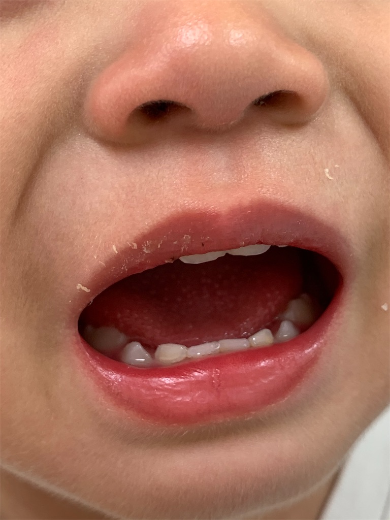 f:id:imo_h_m:20201219075637j:image