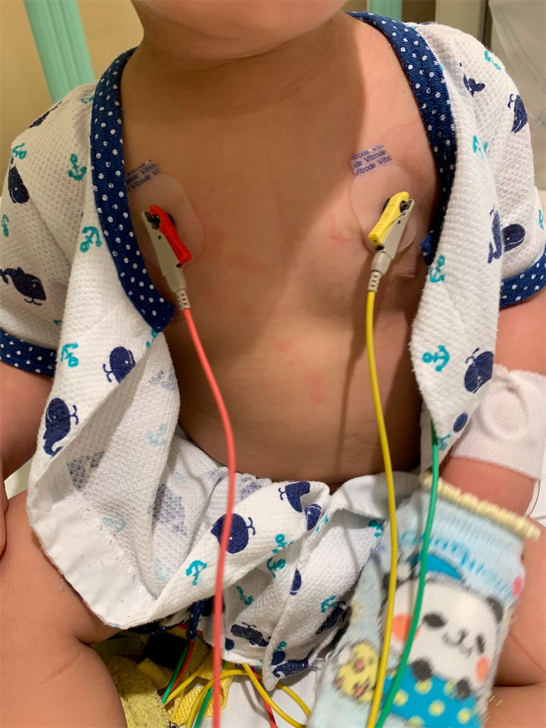 f:id:imo_h_m:20201219075806j:image