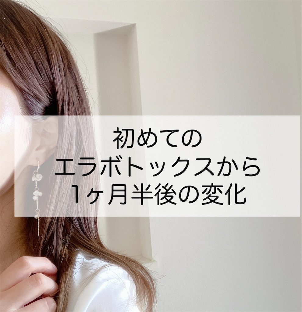 f:id:inamililyflower:20250114111442j:image
