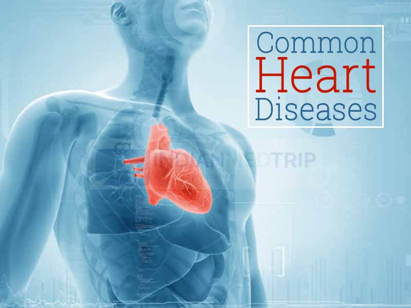 Most Common Types of Heart Diseases indianmedtrip’s blog