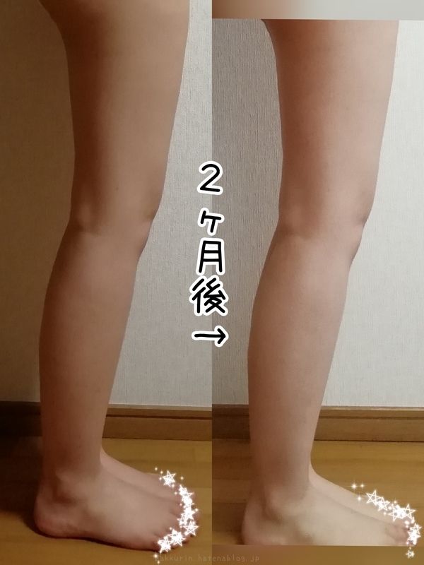 脚痩せなるか 脚パカを2ヶ月実戦した結果と注意点 ザックリン