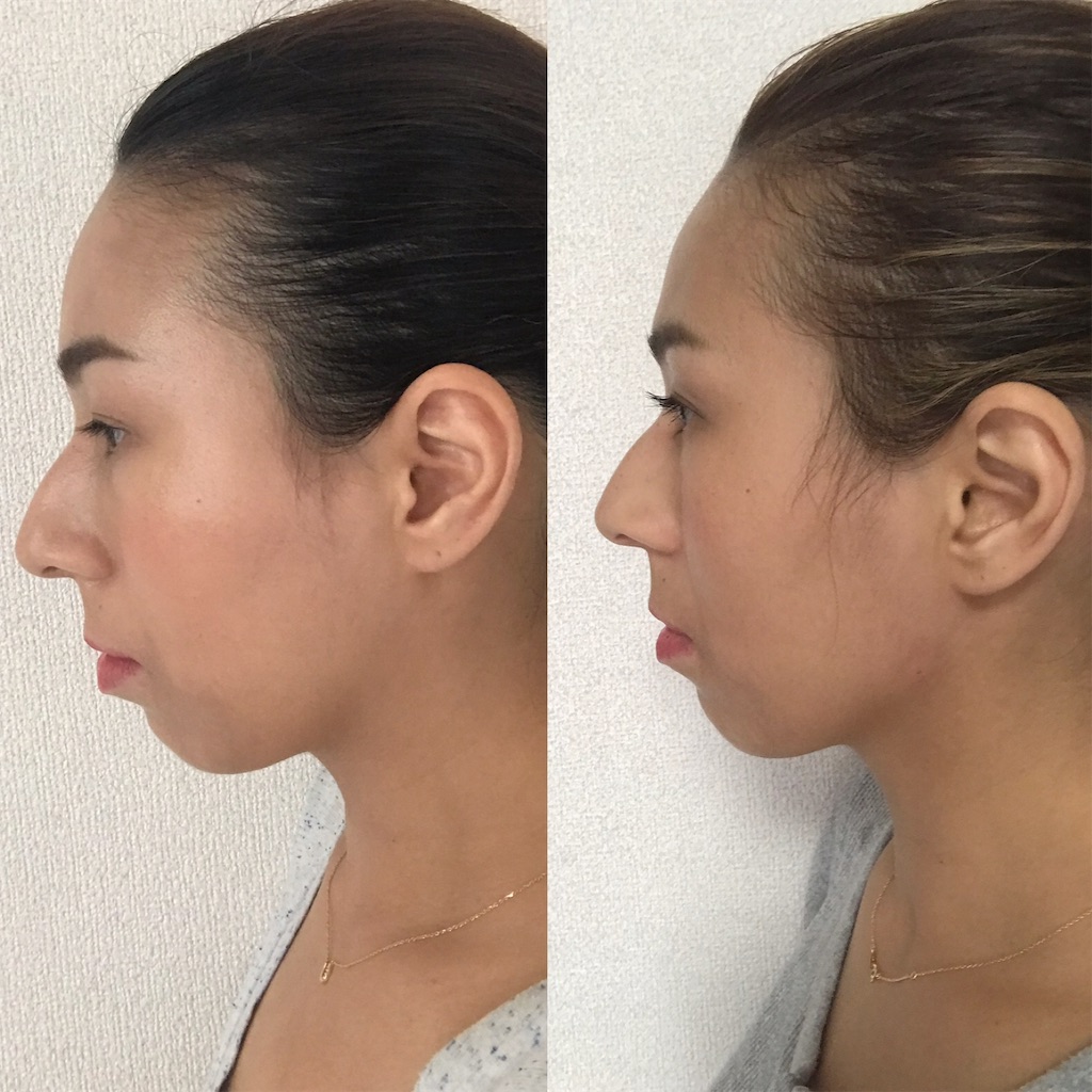f:id:ingeborugu:20190921152530j:image
