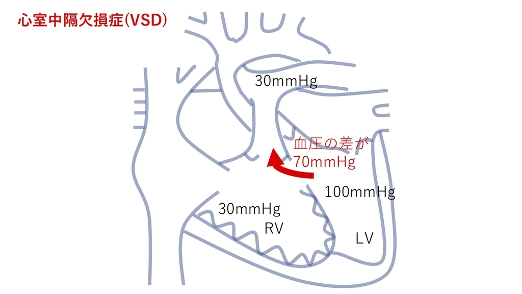 f:id:inishi:20190218124600j:plain f:id:inishi:20190218124600j:plain