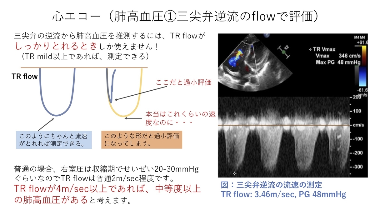 ar pht 基準値 – 大動脈弁閉鎖不全症 pht – AFERRW