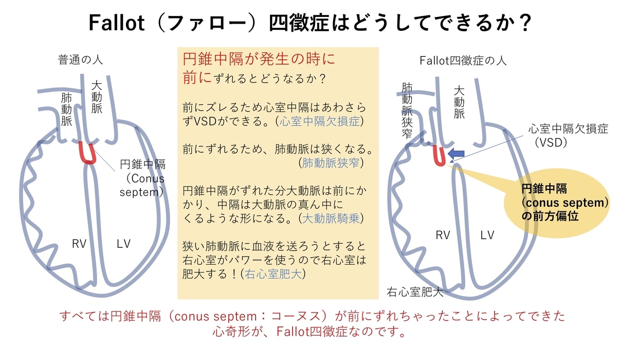 四徴症の治療法は何ですか?