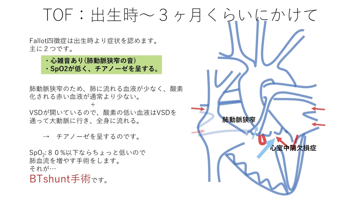 ファロー四徴症の症状は何ですか?