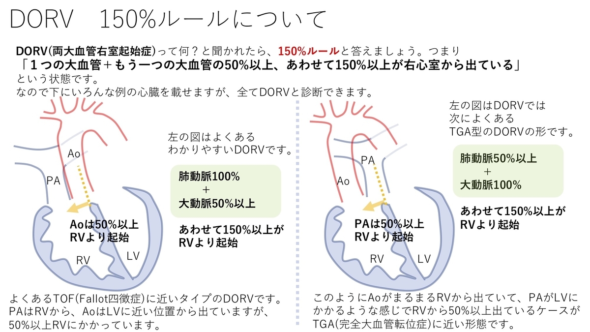 両大血管右室起始症 Dorv について その1 定義や成り立ちなど 疾患36 誰でもわかる先天性心疾患