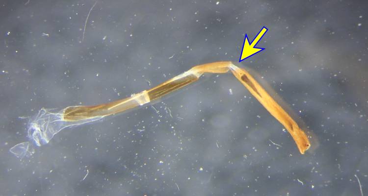 f:id:insectmoth:20170102004715j:plain f:id:insectmoth:20170102004715j:plain