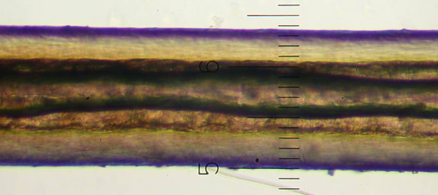 f:id:insectmoth:20170104204456j:plain