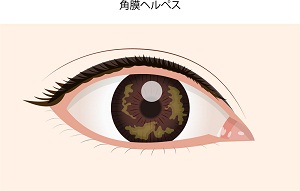 f:id:ioi-asuka:20200702183856j:plain f:id:ioi-asuka:20200702183856j:plain