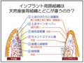 20150514170954