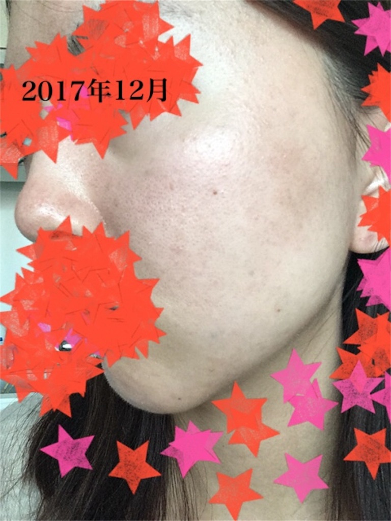 f:id:iwashi27:20180702222052j:image f:id:iwashi27:20180702222052j:image