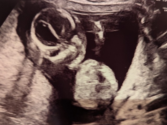 f:id:jackalope0420:20250119190842j:image