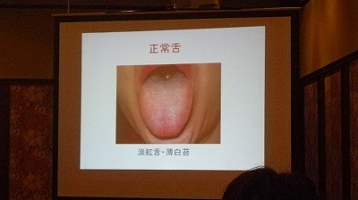 Imgp68911124 舌診の勉強