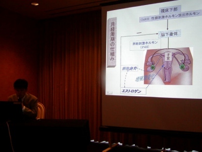 不妊症の講演のスライド