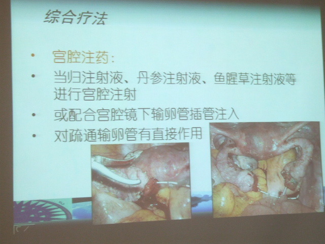 Dscf0423kohoku 免疫性不妊症のスライド