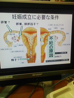 テレビ電話の勉強会