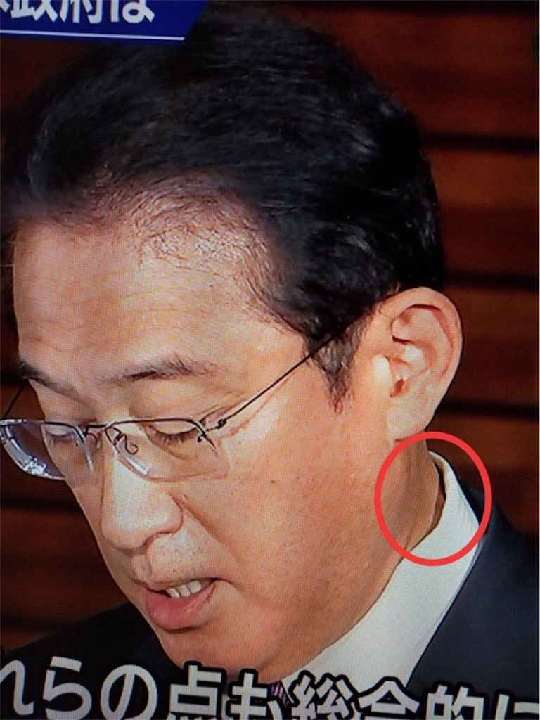 f:id:jigemon2019:20220310220653j:image f:id:jigemon2019:20220310220653j:image