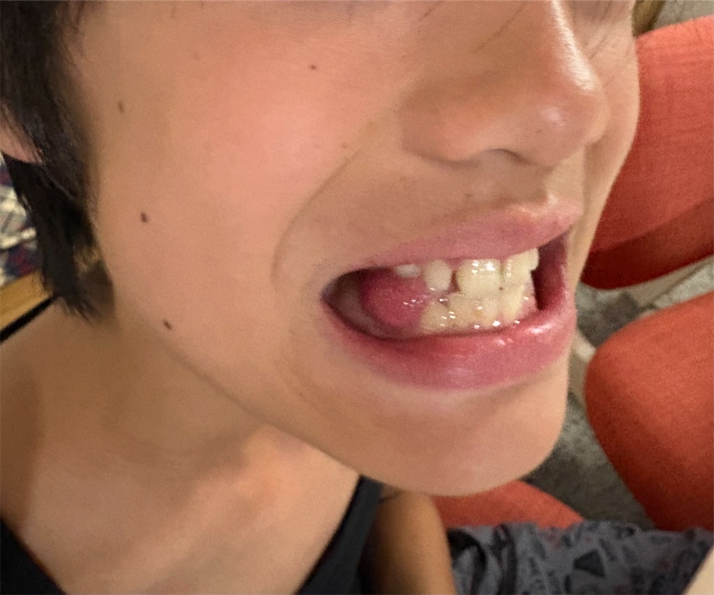f:id:jijigongan:20260729193651j:image