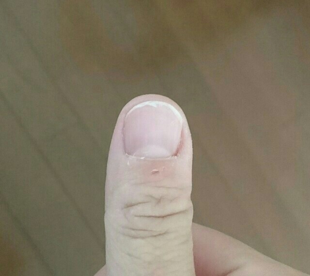 爪が弱い人にオススメ Dr Nail Deep Serumドクターネイル ディープセラムを使ってみました 平凡な主婦が色々試してみるブログ