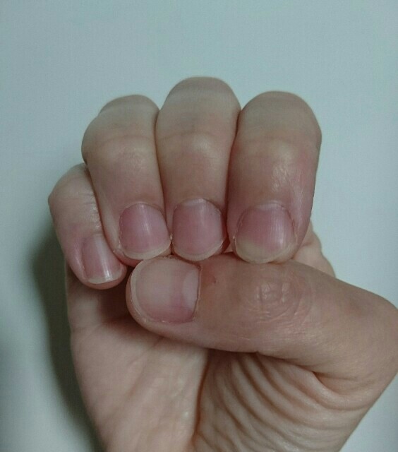 f:id:jinsan77:20161224002133j:image f:id:jinsan77:20161224002133j:image