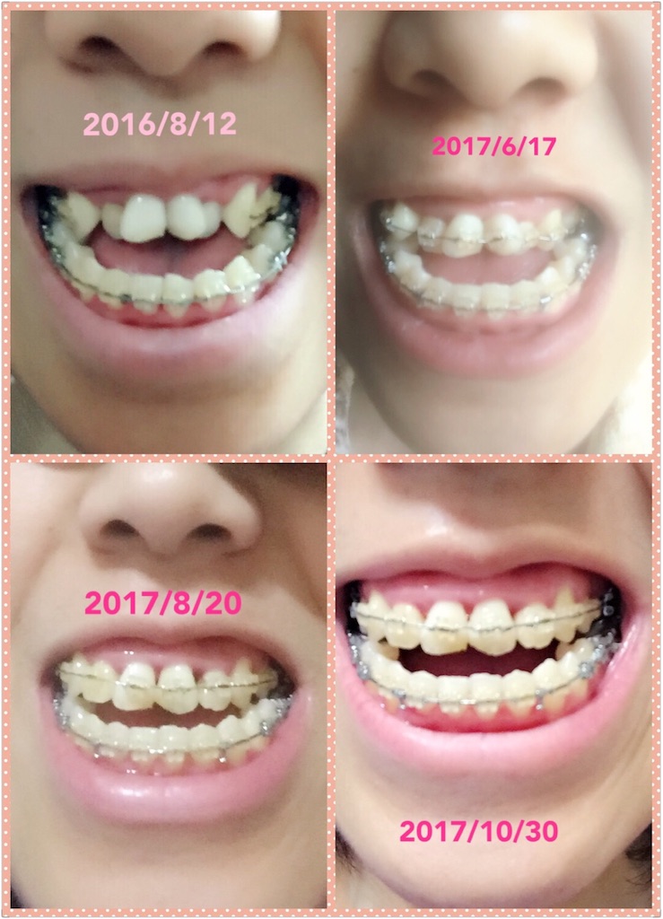 f:id:jj94007:20180426095719j:image