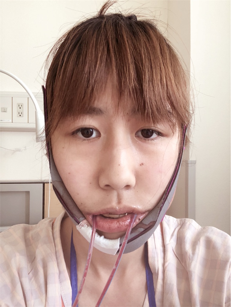 f:id:jj94007:20180426102426j:image